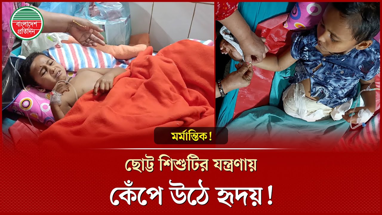 মৃ'ত্যু'র সঙ্গে লড়ছে শিশু আশরাফুল; কোথায় বাবা-মা, কোথায় স্বজন?
